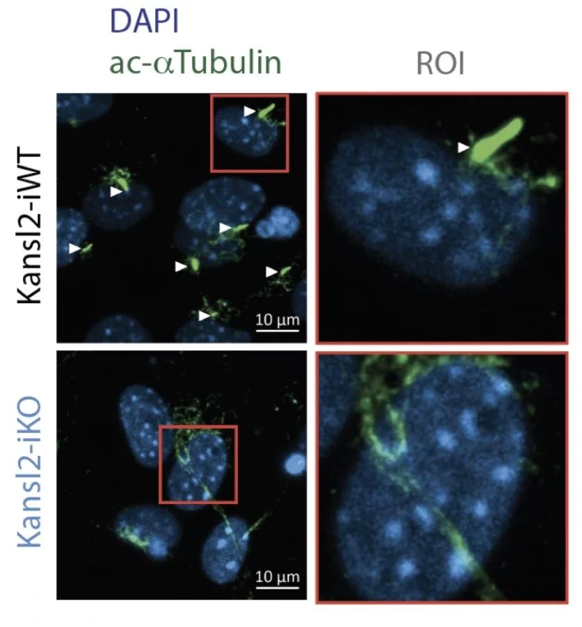 NSL Complex Regulates Intraciliary Transport Genes in Multiple Cell Types