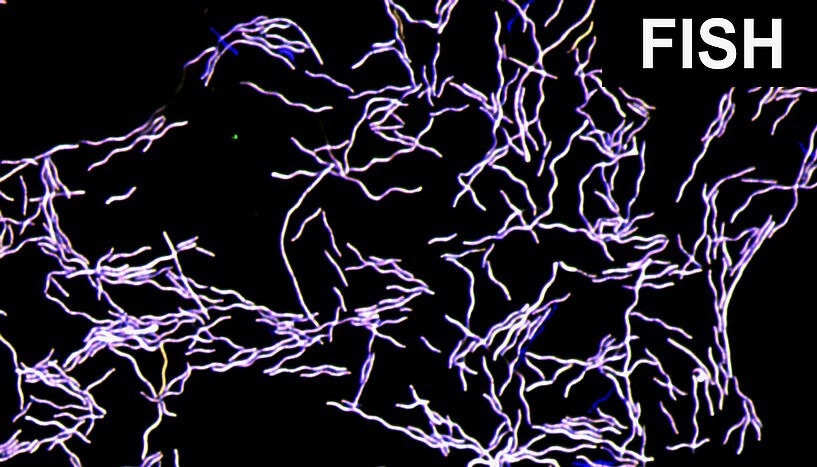 The Impact of Taurine-Degrading Bacteria on Intestinal Microbiome