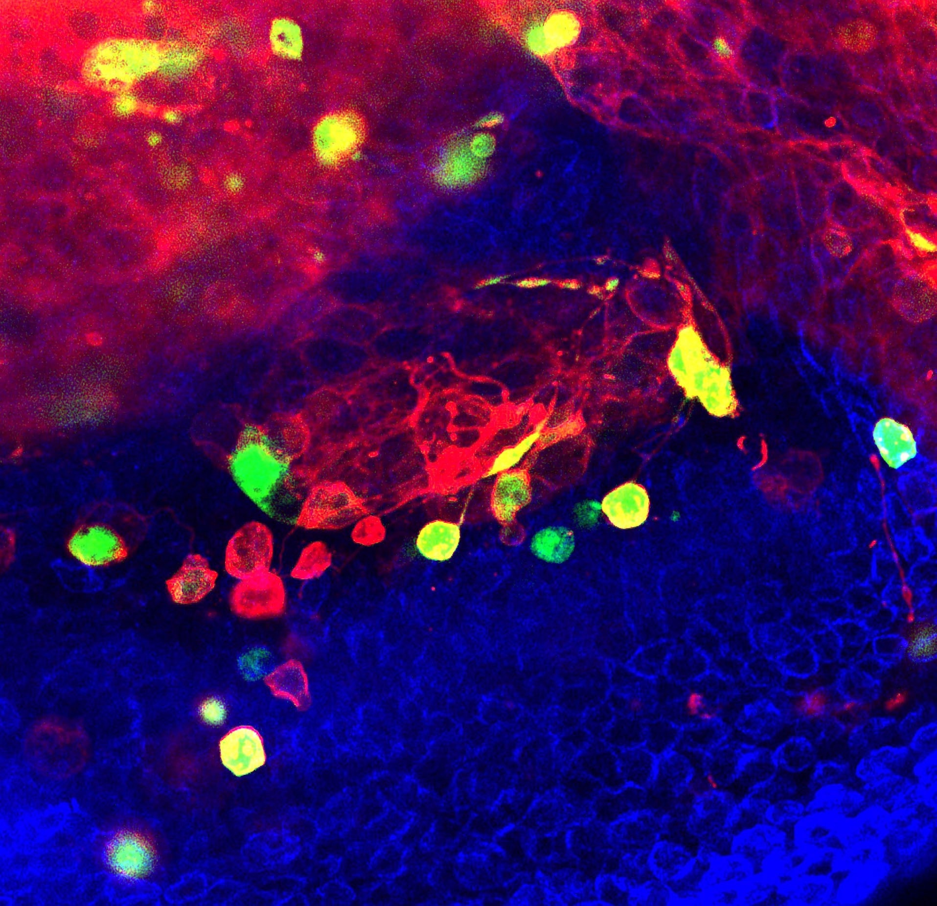 Unraveling the Link Between Chromosomal Instability and Cancer Spread