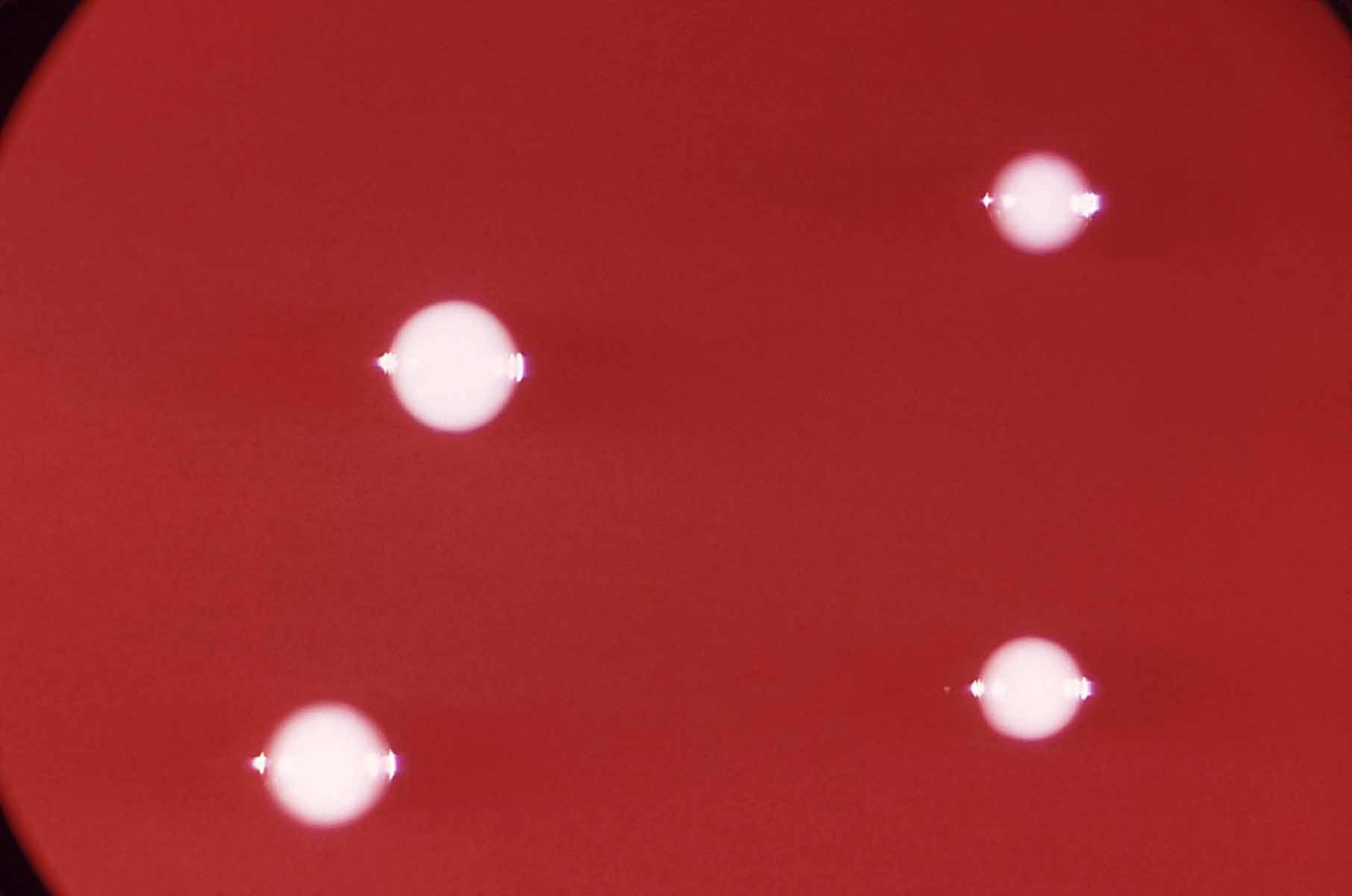 Washing Habits Can Change Skin Microbiome and Affect Skin Health