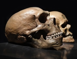 Increased Pain Sensitivity and Neanderthal Gene Variants