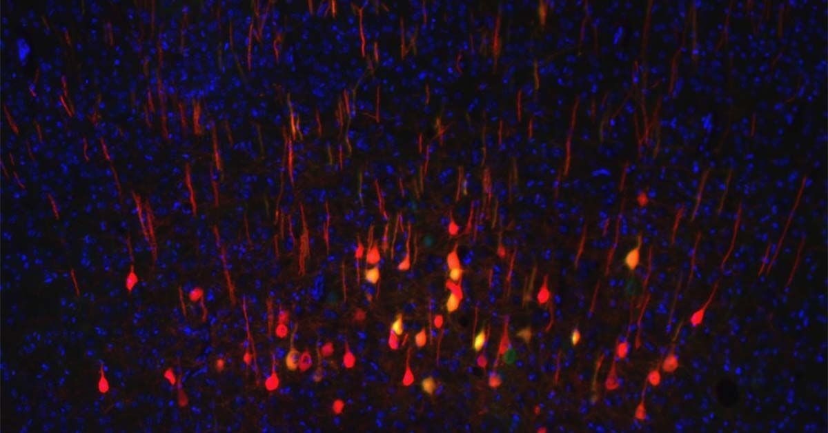 Developing Regenerative Therapies to Treat Neurological Conditions