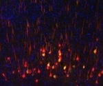 Developing Regenerative Therapies to Treat Neurological Conditions