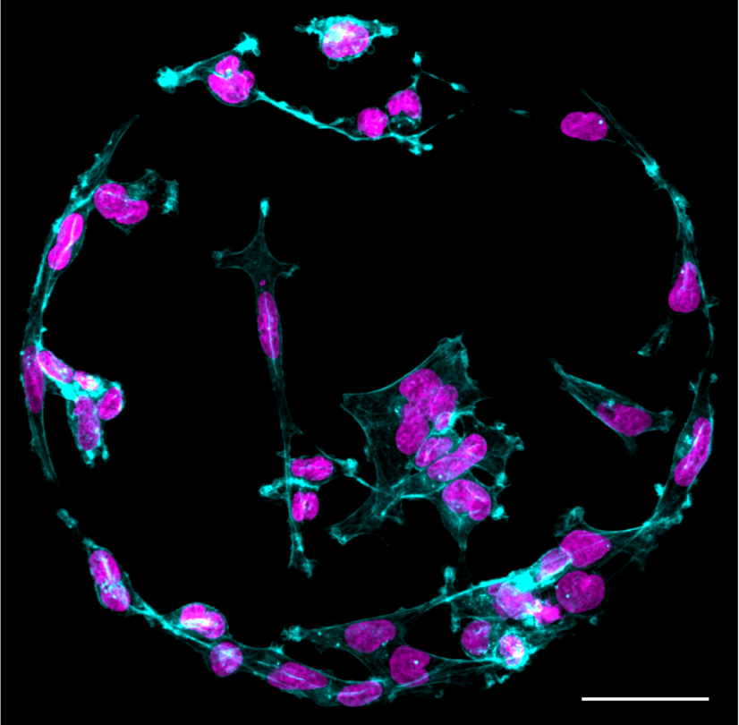New Insight Into How Cancer Cells Function in Softer Tissue Environments