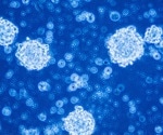 DNA’s Role in Glioblastoma: Insights from Umeå University’s Research