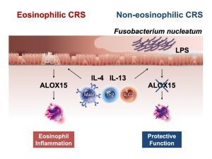 Rising Prevalence of Chronic Rhinosinusitis in Japan: Causes and Implications