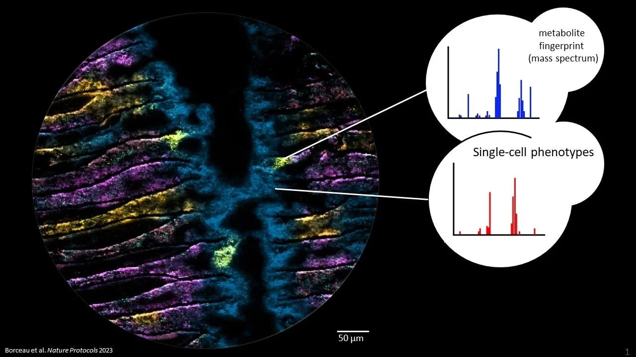 A Glimpse Into the World of Bacterial Metabolism Within Hosts