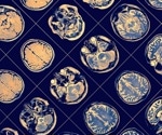 Study Reveals Crucial Protein’s Role in Brain Cell Development
