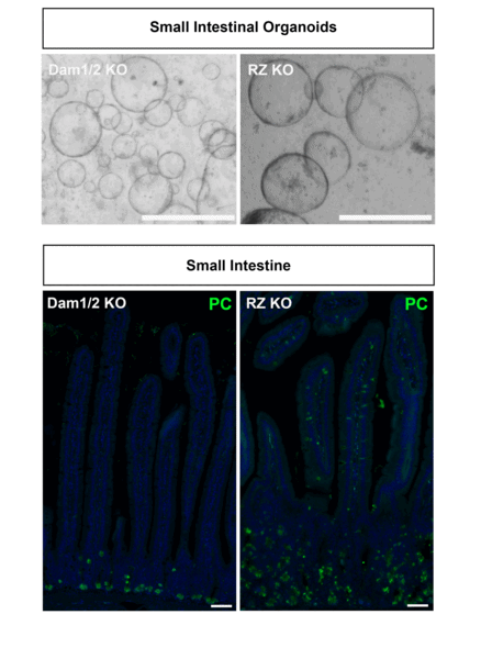 Unraveling Stem Cell Destiny in Intestinal Organoids