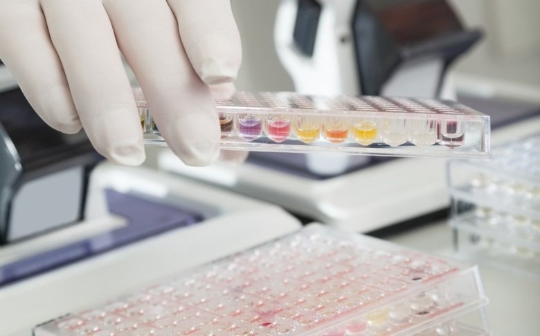 A Novel Technique for Ribonucleotide Quantification