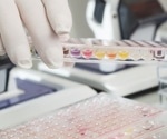 A Novel Technique for Ribonucleotide Quantification