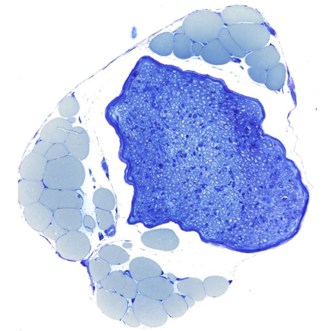 Unlocking the Secrets of Nerve Regeneration