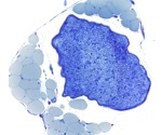 Unlocking the Secrets of Nerve Regeneration