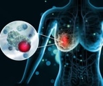 Deciphering the Tumor Microenvironment with Spatial Transcriptomics