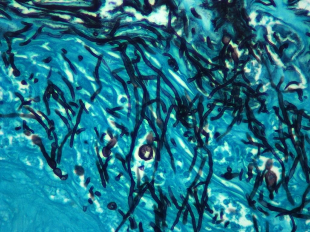 Analyzing The Role of Hypochlorous Acid in the Immune Response Against Fungal Pathogens