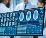 A Computational Toolkit for Brain Imaging Analysis