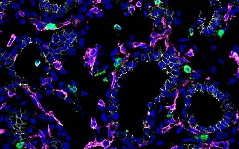 Unveiling Immune-Epithelial Harmony in Fetal Lung Maturation