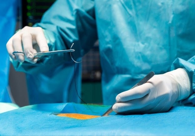 Combating the Illegal Organ Trade with Bio-Printing