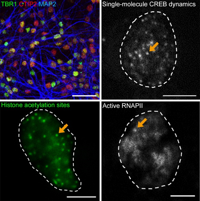 The Foundational Elements of Gene Expression in Brain Development