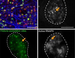 The Foundation of Gene Expression in Brain Development