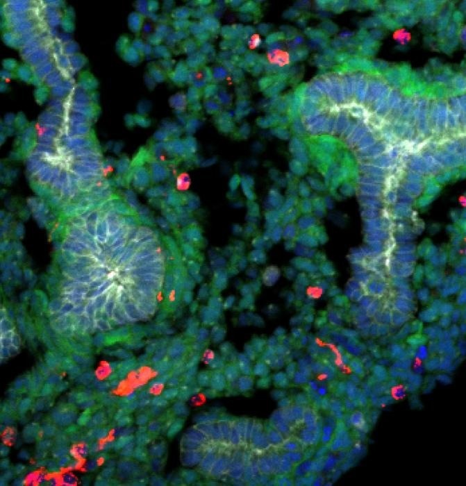 Japanese Scientists Revolutionize Regenerative Lung Medicine