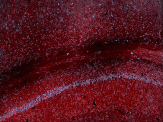 Non-Invasive Gene Expression Tracking in the Brain