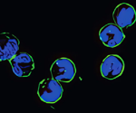 RNAs on the Cell Surface Regulate Neutrophil Recruitment