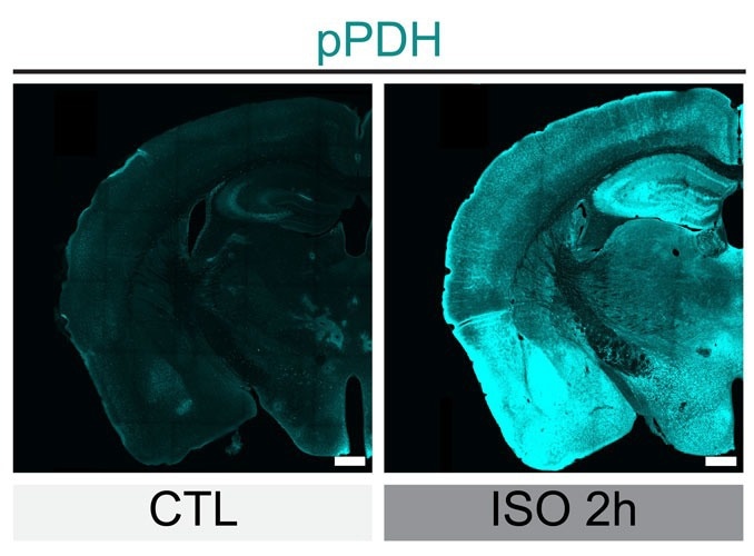 A New Tool for Monitoring Neuronal Inhibition