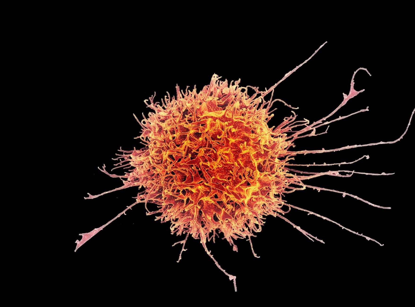 Colorized scanning electron micrograph of a natural killer cell from a human donor.