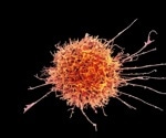 Trapped Inside Tumors: How Dendritic Cells Lose Their Anti-Tumor Abilities