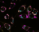 APOE4's Influence on Lipid Droplets in Brain Cells