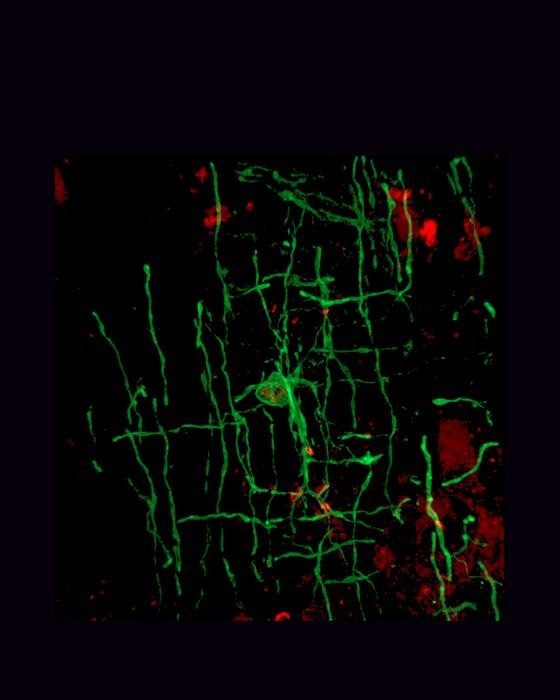 Exploring the Role of Ancient Retroviruses in Evolution of Vertebrate Brains