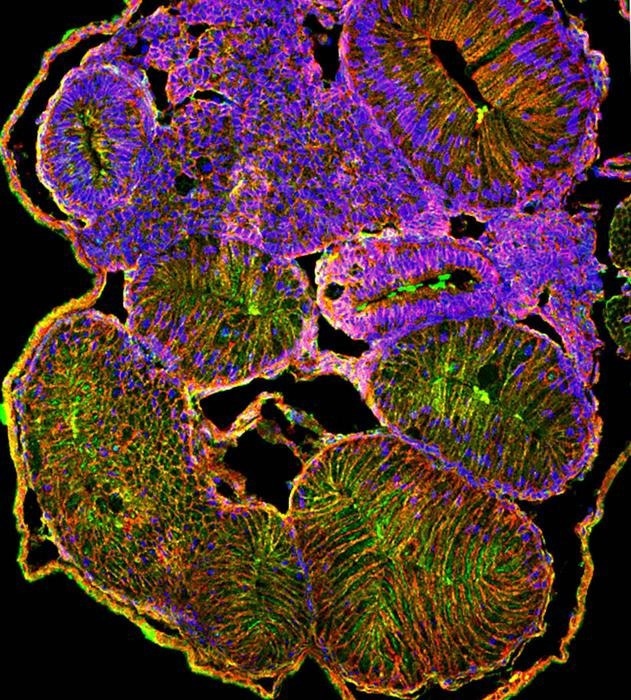 Investigating the Link Between Metabolism and Intestinal Development