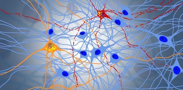 Breaking Down the Complex Mechanisms of Neurodegeneration