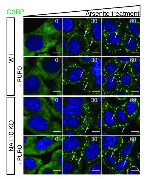 The Role of RNA Modifications in Stress Granule Dynamics