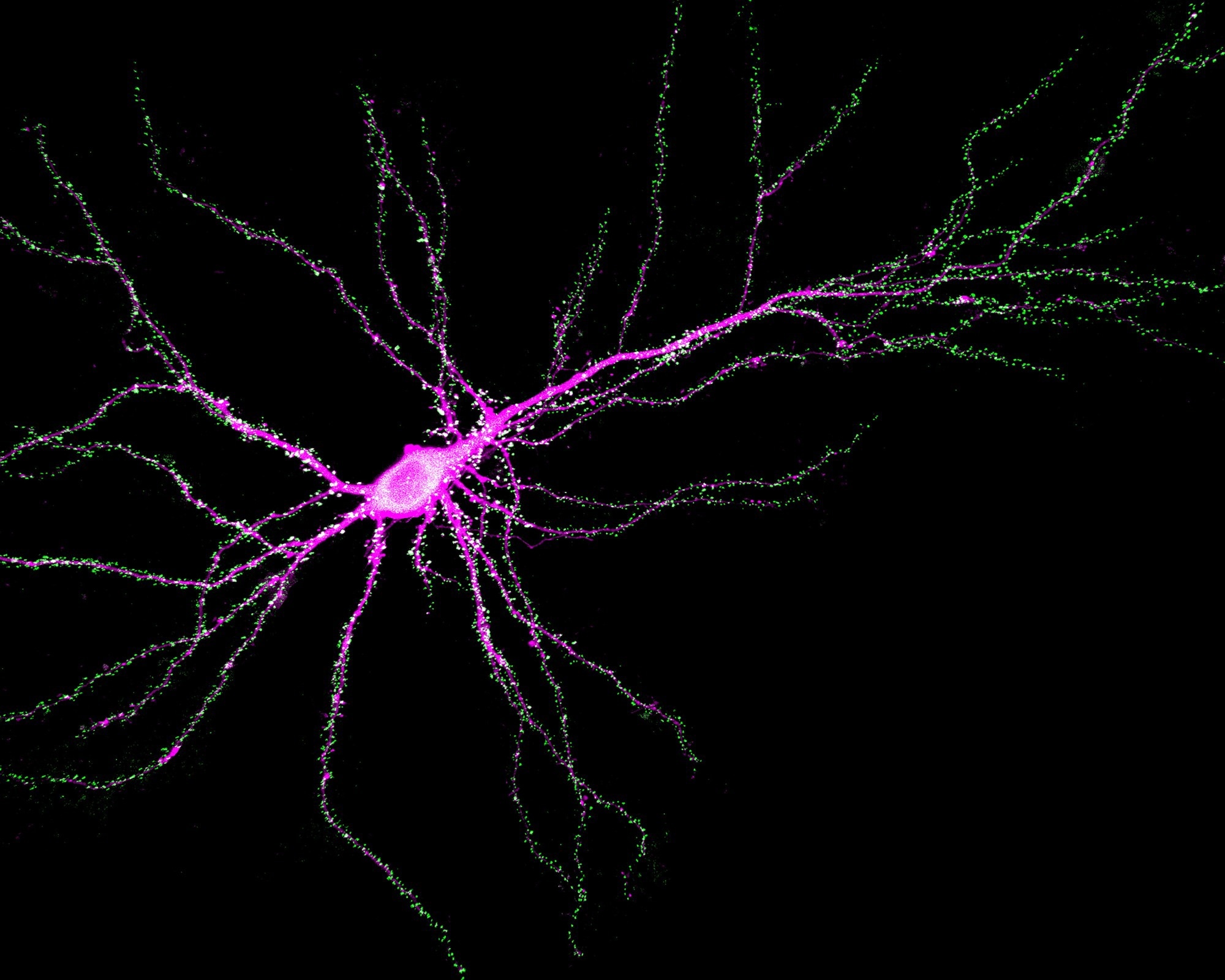 SYNGAP1 Gene Found to Have Dual Function in Brain Development