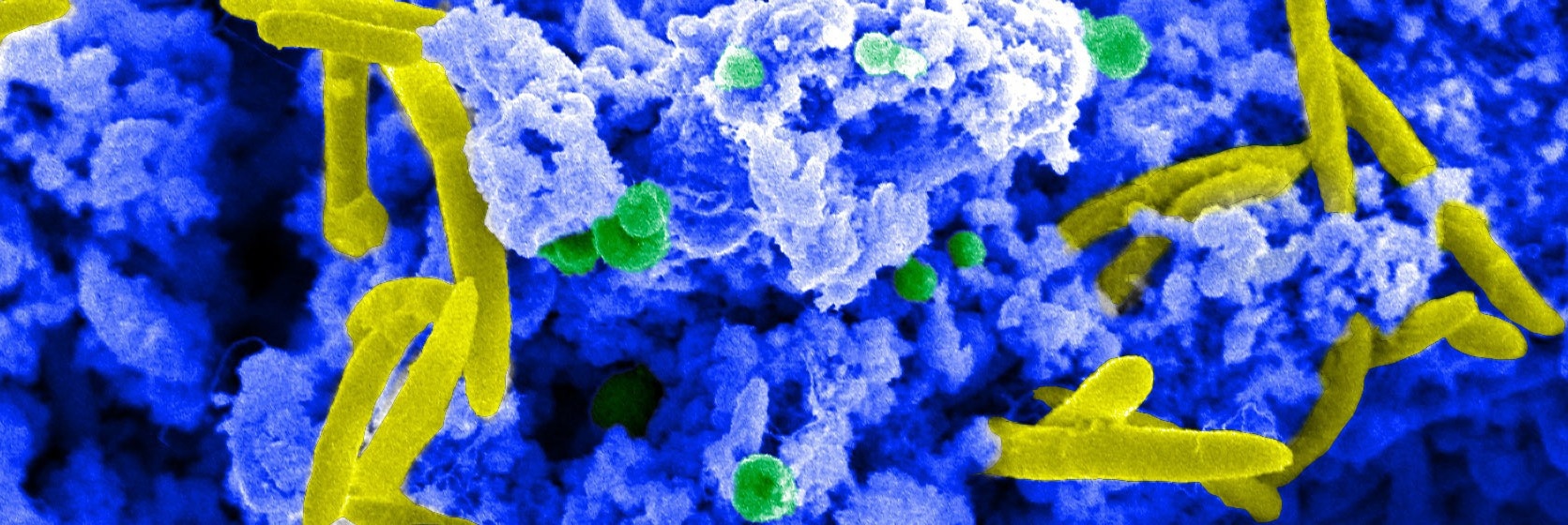 Unlocking the Potential of Microbiome-Based Cancer Therapies