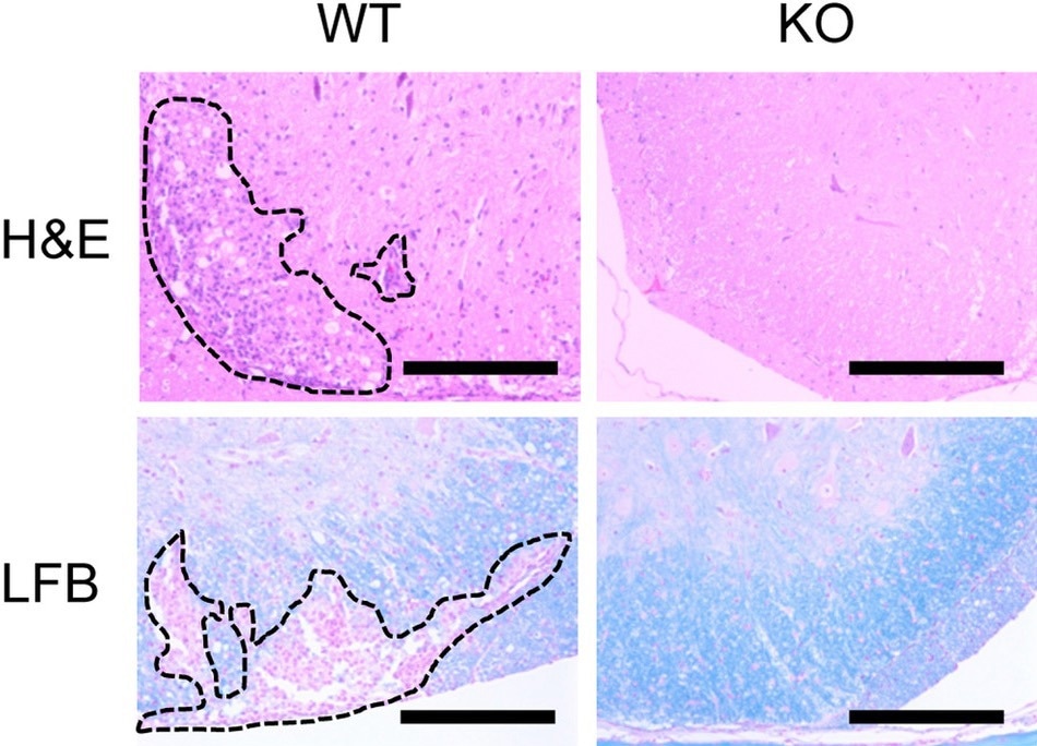Study Reveals Key Role of STAP-1 in Immune Function