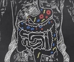 New Research Highlights Gut's Role in Preventing Infections