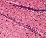 Non-Immune Cells Form Memory, Boosts Inflammatory Response