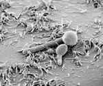 Role of Candidalysin in Gut Microbiome Dynamics