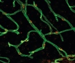 New Study Sheds Light on Blood-Brain Barrier Dysfunction in Aging