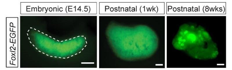 New Study Unveils Mechanism Behind Ovary Development