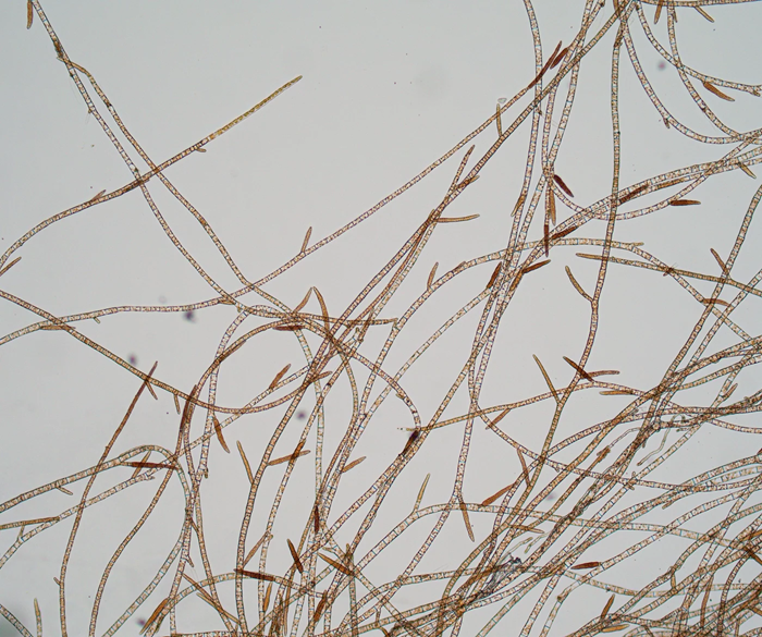 Unraveling the Mysteries of Brown Algae