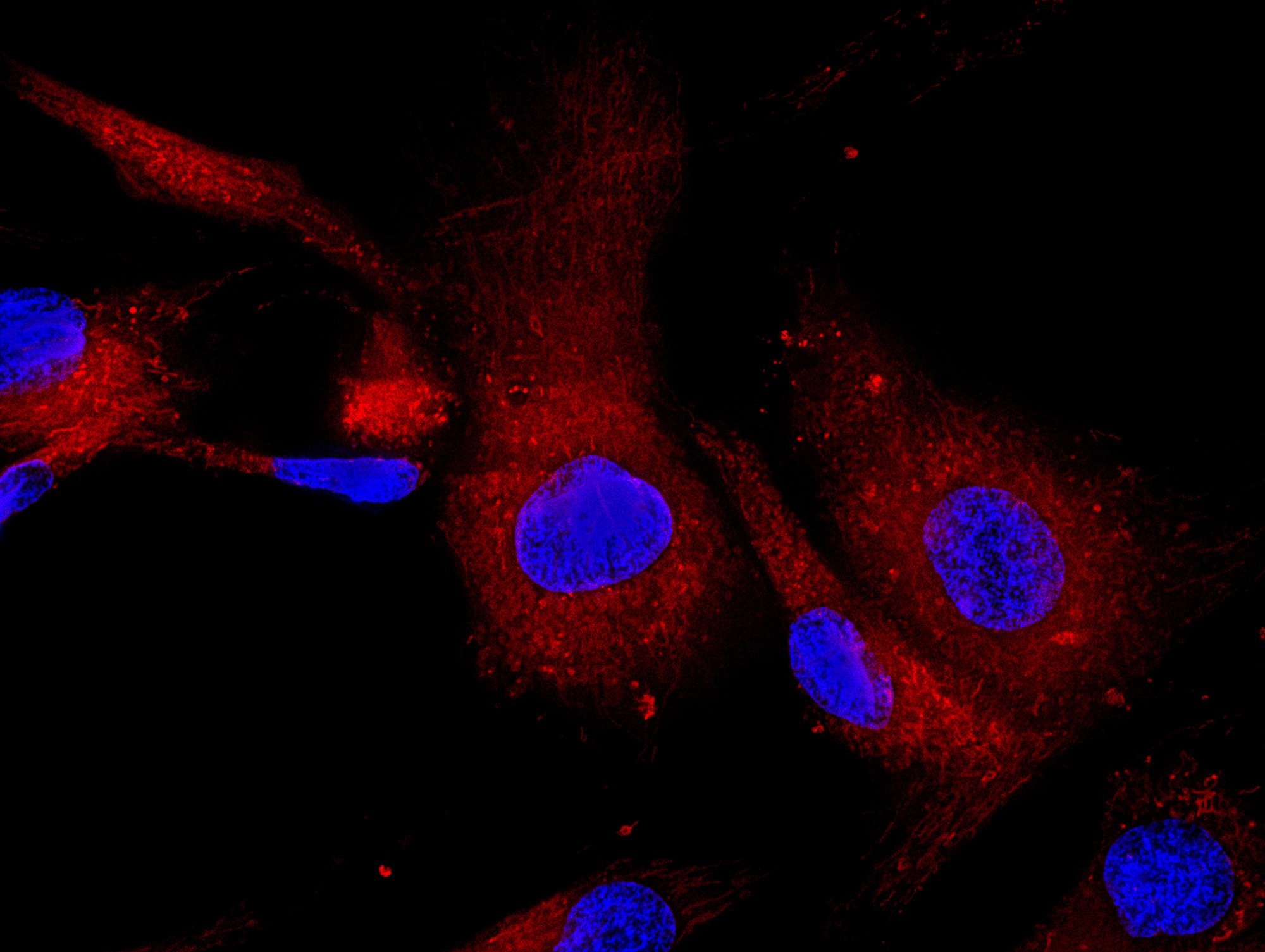 ​​​​​​​Study: Stem cells derived exosomes as biological nano carriers for VCR sulfate for treating breast cancer stem cells. Image Credit: Vshivkova/Shutterstock.com