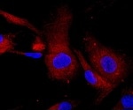Mesenchymal stem cell-derived exosomes carrying vincristine sulfate are effective in killing cancer stem cells