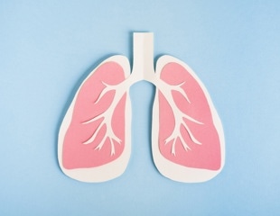 Integrative genomic study identifies two new potential drug targets in Mycobacterium tuberculosis