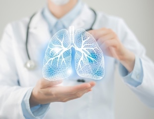 Inverse relationship found between anti-inflammatory macrophages and NK cells/T cells in lung cancer