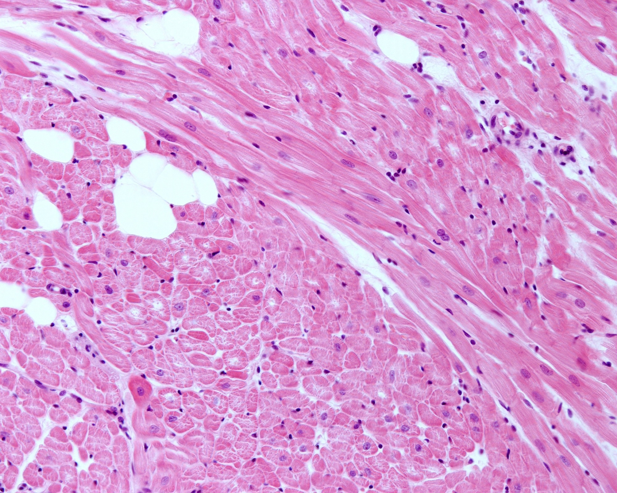 ​​​​​​​Study: Mitochondria regulate proliferation in adult cardiac myocytes. Image Credit: Jose Luis Calvo/Shutterstock.com