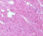 Mitochondria Influence the Ability of Adult Cardiac Cells to Multiply